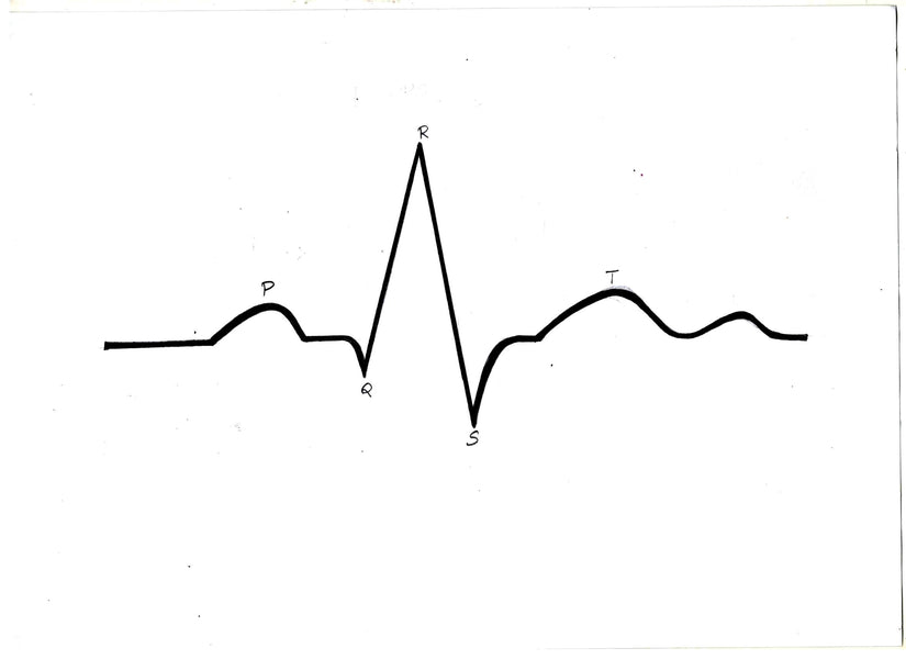 Three(3),Five(5),Ten(10) Lead ECG Lead /Cable/Electrode Placement